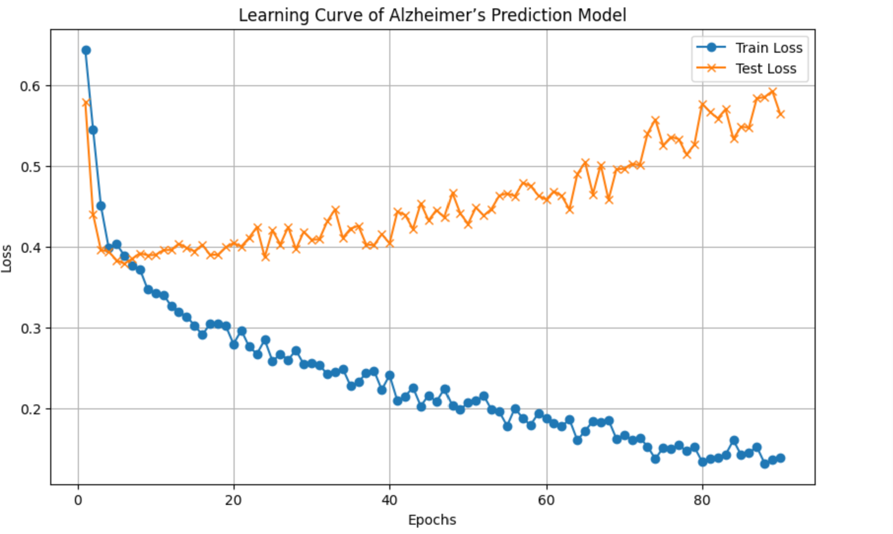 Alzheimer's Prediction Model